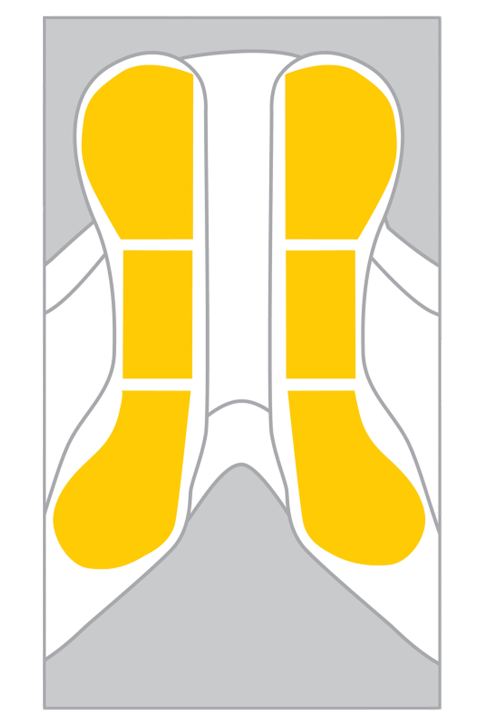 Wintec EASY-CHANGE- Riser Standard Set